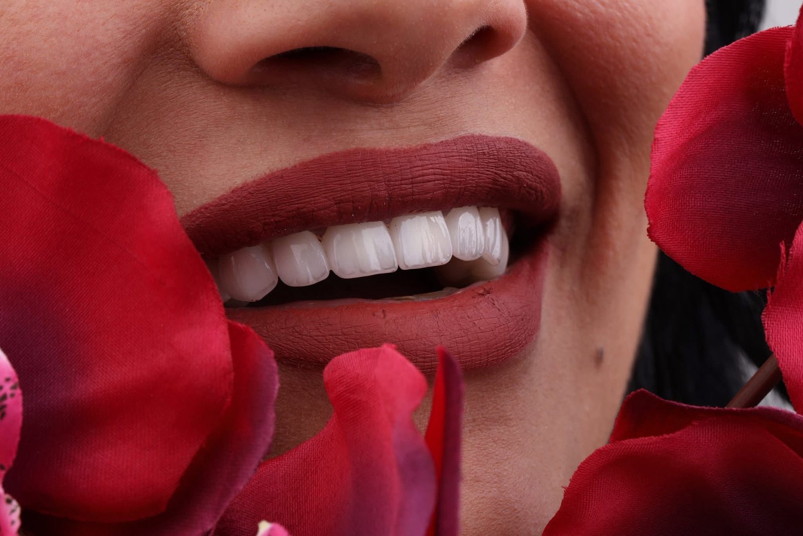 Smile case study