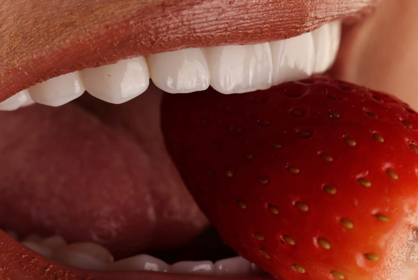 Smile case study