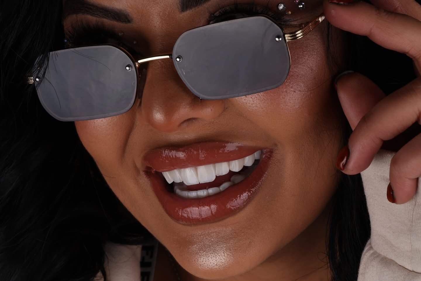 Smile case study