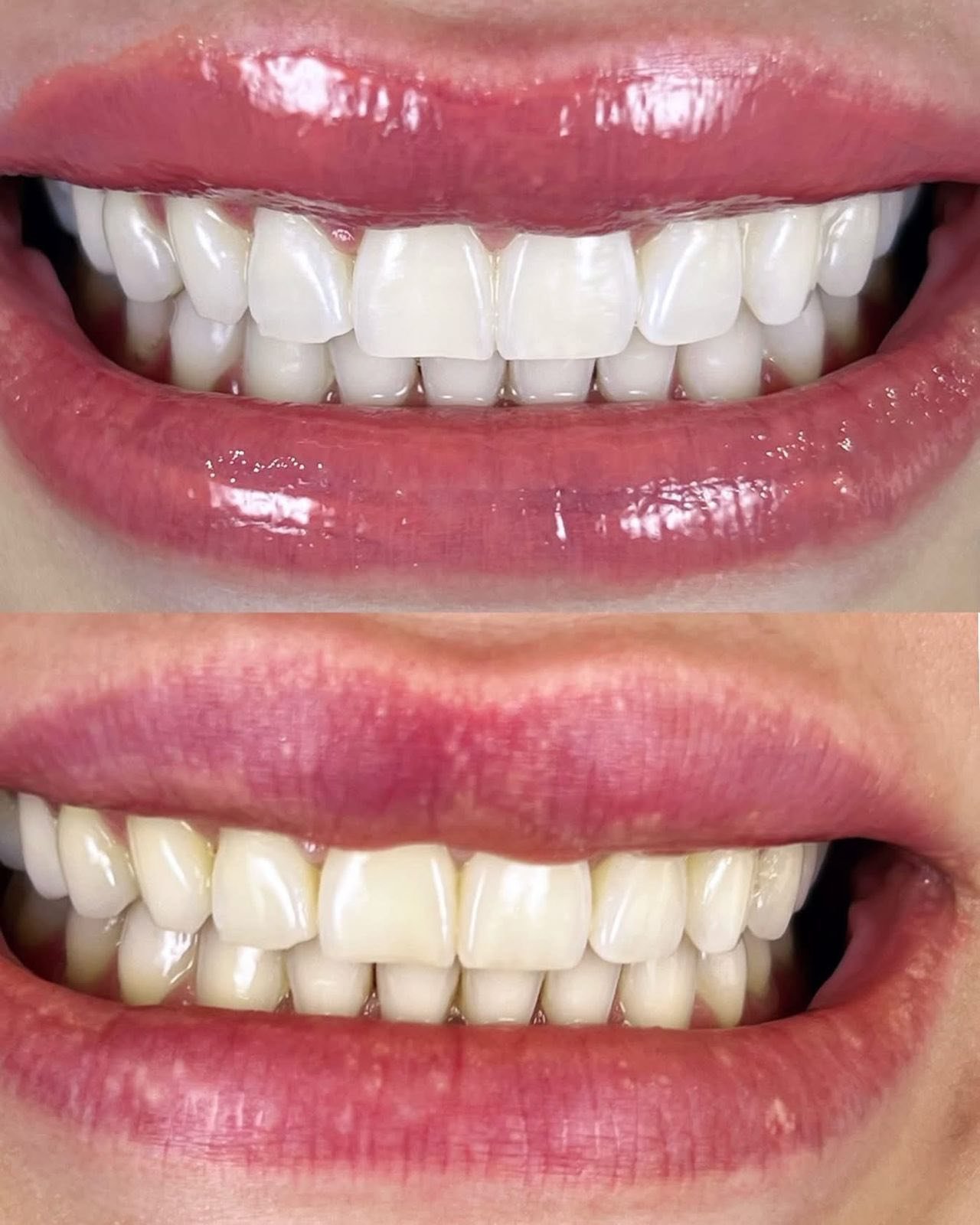 After Treatment Case 1